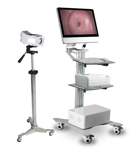 Digital Optical Colposcope