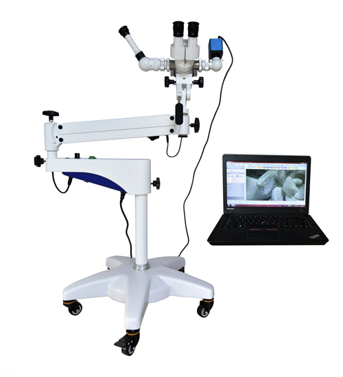 Colposcope optique vente chaude