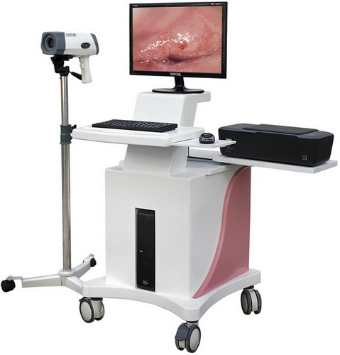 Digital Electronic Colposcope