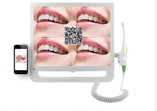 Dental Oral Camera