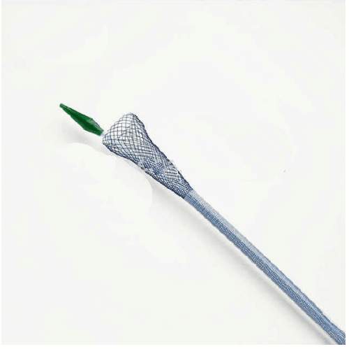 Stent œsophagien anti-reflux