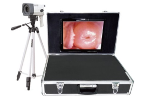 Portable Digital electronic colposcope