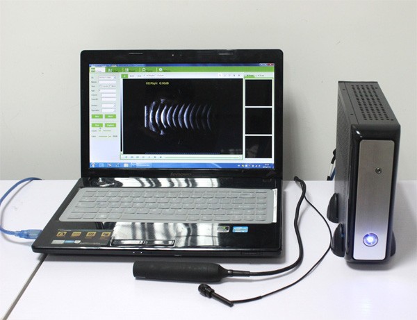 Scanner A/B à ultrasons ophtalmiques