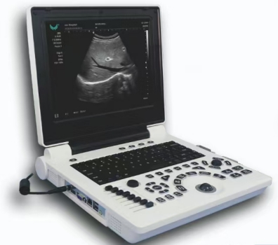 Notebook Ultrasound Scanner(3D software Optional)