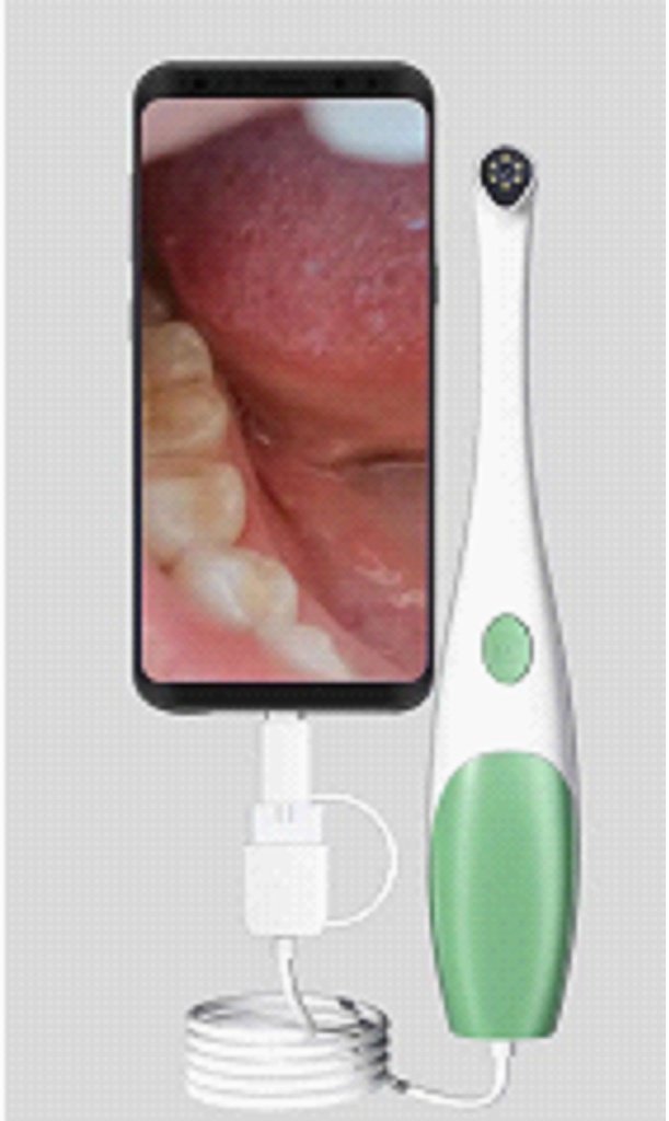 3-in-1 Smart HD Visual Dental Mirror