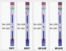 [CCLHIV01] HIV 1/2 Human Virus 1/2 Test, 3.0mm, Strips, 50Tests/Box