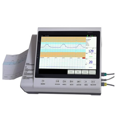 [CCLFM6018] monitor fetal