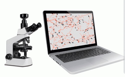 [CCT-3702II] Analizador de calidad de esperma portátil de mesa